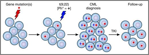 Preleukemic cells in CML and clonal hematopoiesis after TKI therapy. A hematopoietic stem and progenitor cell acquires a gene mutation or mutations and clonally expands (ie, becomes a preleukemia clone). A preleukemia cell gains a Ph chromosome and expands, and clinical CML develops. After treatment with a TKI, Ph+ cells are eradicated, and residual mutant Ph− preleukemic cells expand and contribute to clonal hematopoiesis.