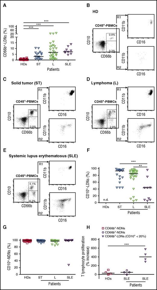 Figure 7. Frequency and phenotypic characterization of CD66b+ LDNs from solid tumor, lymphoma, or SLE patients. (A) Frequency of CD66b+ LDNs in PBMCs from HDs (n = 33) or patients with solid tumors (ST) (n = 17), lymphoma (L) (n = 28), or SLE patients (n = 9). Graph values indicate medians from independent experiments. Each symbol stands for a single HD or ST, L, or SLE patient. ***P ≤ .001, by 1-way ANOVA with the Dunnett posttest. (B-E) Representative FACS plots of CD11b and CD16 expression in CD10+ (R1) or CD10− (R2) cells within CD66b+ LDNs from PBMCs of HDs (B), ST patients (C), L patients (D) or SLE patients (E). (F-G) Frequency of CD10+ LDNs within CD66b+ LDNs (F) or CD66b+ NDNs (G) from HD (n = 33), ST patients (n = 17), L patients (n = 28), or SLE patients (n = 9). Graph values indicate medians from independent experiments. Each symbol stands for a single HD, ST, L, or SLE patient. **P ≤ .01; ***P ≤ .001, by 1-way ANOVA with the Dunnett posttest. (H) CD3/CD28-stimulated T cells were cultured for 96 hours in the presence or absence of CD66b+ NDNs from HDs or CD66b+ NDNs and CD66b+ LDNs from SLE patients at a 5:1 neutrophil-to-T-cell ratio. The percentage of increase of T-cell proliferation, as measured by BrdU incorporation, is reported. Graph values indicate medians from independent experiments (n = 4). ***P ≤ .001, by 1-way ANOVA with the Dunnett posttest.