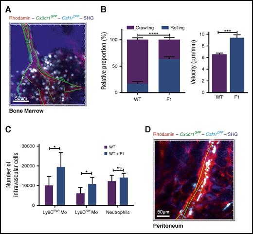 Figure 5. CX3CR1 blockade induces systemic monocyte demargination. (A) 3D-TPLSM image of the skull BM from MacBlue×Cx3cr1gfp/+ 4 hours after LPS treatment in the presence of F1 (50 µg injected intraperitoneally) (original magnification ×196). Track paths (green line) showing monocyte behavior in the vasculature (red) are represented. (B) Quantification of the relative proportion of crawling and rolling monocytes and their mean velocity in the vascular lumen of the BM sinusoids from MacBlue×Cx3cr1gfp/+ treated (F1) or not (WT) with CX3CR1 antagonism (bars represent mean ± SEM; data are pooled from different movies out of 2 independent experiments at least. Kruskal-Wallis with Dunn’s multicomparison tests is performed). (C) Quantification by flow cytometry of intravascular Ly6Chigh, Ly6Clow monocytes, and neutrophils in WT and treated (F1) after in vivo CD45 intravascular staining (bars represent mean ± SEM from at least 6 different mice per time point out of at least 2 independent experiments; Kruskal-Wallis with Dunn’s multicomparisons test is performed. The significance between mouse strains is indicated by black * for each time point, and Mann-Whitney test is performed). *P < .05; ***P < .001; ****P < .0001; ns, nonsignificant. (D) In vivo 3D-TPLSM image of the peritoneal vasculature showing the defect in ECFP+ monocyte adherence to endothelium (red) 4 hours after LPS treatment in the presence of F1 (see supplemental Video 7; original magnification ×150).