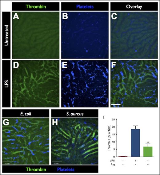 Figure 1. Imaging intravascular coagulation in sepsis. Representative SD-IVM images of the liver microcirculation in untreated (A-C), endotoxemic (D-F), E coli–infected (G), and S aureus–infected (H) mice. Thrombin probe fluorescence is shown in green (note the level of background autofluorescence of the liver parenchyma shown in panel A), and platelets are shown in blue (AF647 anti-CD49b). Bar represents 50 μm. (I) Quantitative analysis of thrombin probe fluorescence within the liver microcirculation of untreated control mice, LPS-treated mice, or LPS-treated mice that received a direct thrombin inhibitor (argatroban). Data are shown as mean ± SEM. **P < .01; N = 3-6 mice per group.