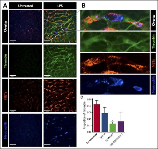 Figure 2. Spatial relationship between thrombin activity and NETs in the microvasculature. (A) Representative SD-IVM images of the liver microcirculation of untreated and LPS-treated mice. Thrombin probe fluorescence is in green, NETs are shown in red (AF555 anti-H2Ax), and neutrophils are shown in blue (AF647 anti-Gr1). Bars represent 50 μm. (B) Magnified inset showing a liver sinusoid containing an adherent neutrophil (blue), surrounding NETs (red), and the associated thrombin activity (green). (C) The regions of the highest thrombin probe signal within each liver sinusoid (per field of view) were identified in LPS-treated mice and categorized according to the spatial relationship with the nearest NET relative to the direction of blood flow: downstream, within NET, upstream, or not associated (>100 μm from the nearest NET). Data are represented as mean ± SEM. *P < .05; N = 4 mice per group.