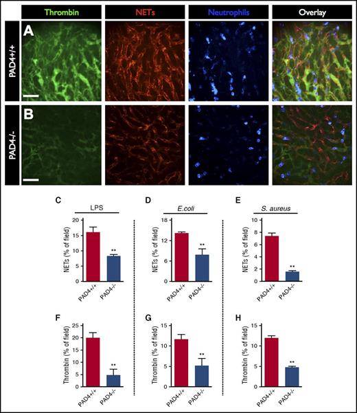 Figure 3. Reducing NET production in PAD4-deficient mice reduces intravascular coagulation. Representative SD-IVM images of the liver microcirculation of wild-type (A, PAD4+/+) and PAD4−/− (B) mice 4 hours after LPS administration. Thrombin probe fluorescence is in green, NETs are shown in red (AF555 anti-H2Ax), and neutrophils are shown in blue (AF647 anti-Gr1). Bars represent 50 μm. Quantitative analysis of NETs (C-E) and thrombin probe fluorescence (F-H) within the liver microvasculature of wild-type (PAD4+/+) and PAD4−/− mice after administration of LPS, E coli infection, or S aureus infection. Data are represented as mean ± SEM. **P < .01; N = 3-6 mice per group.