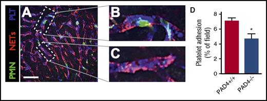 Figure 4. Minor contribution of NET-platelet interaction to microvascular platelet adhesion. (A) Representative SD-IVM image of the liver microvasculature of an endotoxemic wild-type (PAD4+/+) mouse showing neutrophils (green, AF488 anti-Gr1), NETs (red, AF555 anti-H2Ax), and platelets (blue, AF647 anti-CD49b). Bar represents 50 μm. (B) Magnified inset showing platelets (blue) aggregating on the surface of an adherent neutrophil (green). (C) Magnified inset showing platelets (blue) adhering to a NET (red). (D) Quantitative analysis of platelet adhesion within the liver sinusoids of wild-type (PAD4+/+) and PAD4−/− mice. Data are represented as mean ± SEM. *P < .05; N = 4-6 mice per group.