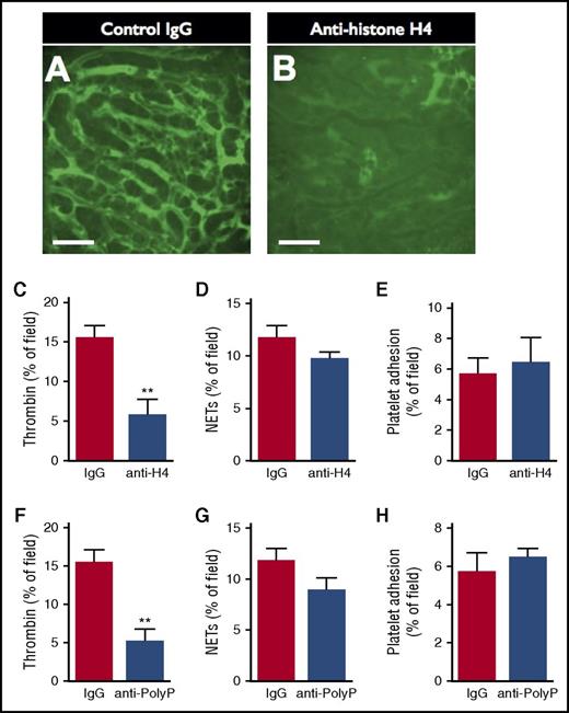 Figure 5. Neutralization of histone H4 or PolyP reduces intravascular thrombin activity, but not platelet adhesion or NET production. Representative SD-IVM images of thrombin probe activity (green) within the liver microcirculation of endotoxemic wild-type mice treated with (A) control IgG versus (B) anti-histone H4 IgG. Bars represent 50 μm. (C-D) Quantitative analysis of (C) thrombin probe fluorescence, (D) NETs, and (E) platelet adhesion within the liver sinusoids of endotoxemic wild-type mice treated with control IgG or anti-histone H4 IgG. (F-H) Quantitative analysis of (F) thrombin probe fluorescence, (G) NETs, and (H) platelet adhesion within the liver sinusoids of endotoxemic wild-type mice treated with control IgG or antipolyphosphate IgG. Data are represented as mean ± SEM. **P < .01; N = 5 mice per group.