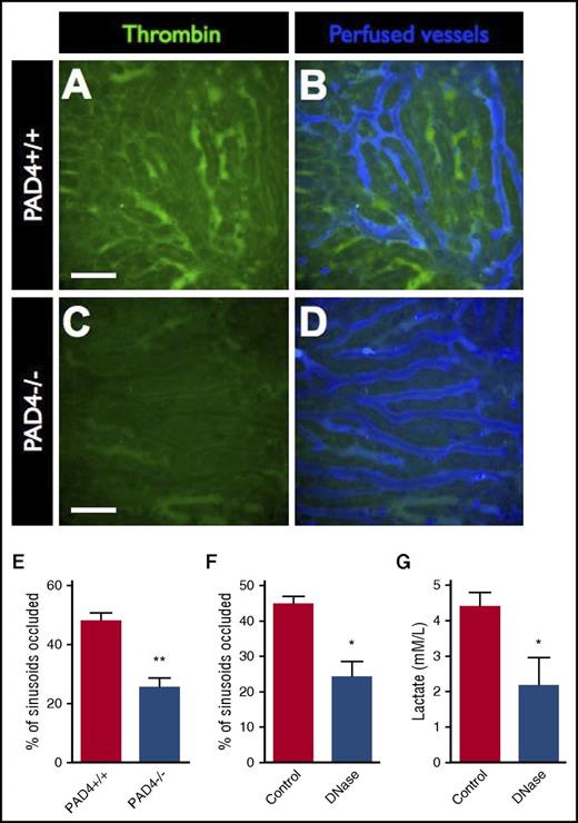 Figure 6. Blocking NETs-induced intravascular coagulation restores microvascular perfusion. Representative SD-IVM images of the liver microcirculation of endotoxemic wild-type (PAD4+/+) (A-B) and PAD4−/− (C-D) mice. Thrombin probe activity is shown in green. Mice were then injected with AF647-albumin (blue) as a contrast material to identify perfused versus occluded vessels. Bars represent 50 μm. The proportion of occluded vessels was quantified per field of view in (E) endotoxemic wild-type (PAD4+/+) versus PAD4−/− mice and (F) endotoxemic mice treated with IV DNase versus vehicle control. (G) Serum lactate levels were quantified in blood samples from septic mice (24 hours after i.p. infection with E coli) treated with IV DNase versus vehicle control. Data are represented as mean ± SEM. **P < .01, *P < .05; N = 3-6 mice per group.