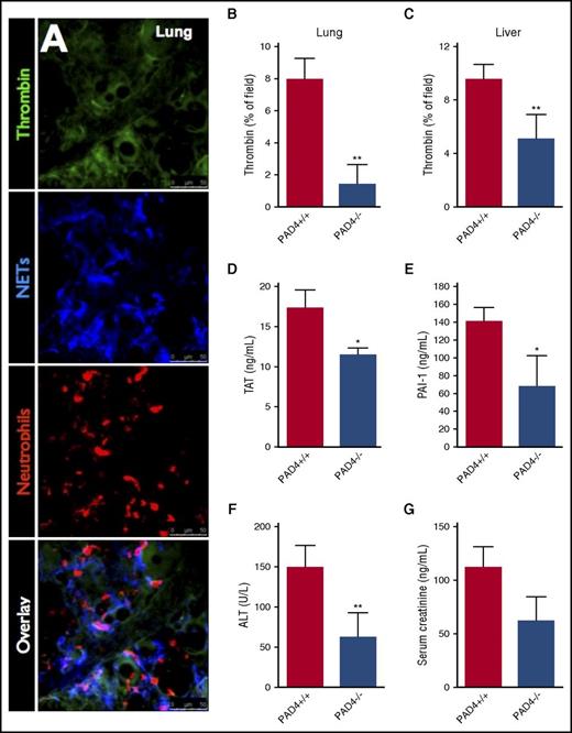 Figure 7. Inhibition of NETs attenuates intravascular coagulation and end-organ damage in sepsis. (A) Representative resonance-scanning confocal intravital microscopy images of the lung microvasculature of endotoxemic mice showing intravascular thrombin activity (green), NETs (blue, AF647 anti-NE), and neutrophils (red, PE-anti-Gr1). Microvascular thrombin probe fluorescence was quantified in the lung microvasculature in response to intratracheal LPS (B), and liver microvasculature in response to i.p. E coli (C) in PAD+/+ and PAD4−/− mice. (D) Plasma TAT levels were quantified in PAD4+/+ and PAD4−/− mice 6 hours after IV S aureus infection. Plasma levels of (E) PAI-1, (F) ALT, and (G) creatinine were measured in PAD4+/+ and PAD4−/− mice with E coli peritonitis (24 hours postinfection). Data are represented as mean ± SEM. **P < .01, *P < .05; N = 5-10 mice per group.