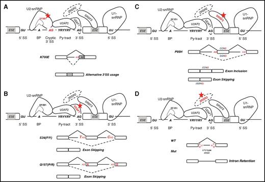 Figure 2. Splicing factor (trans-acting) mutations and their impact on splicing in hematologic malignancies. (A) SF3B1 mutations lead to alternative 3′ splicing site (SS) usage because of the increased recognition of cryptic splice sites between the branch point and the canonical 3′ splice site. (B) U2AF1 mutations affect 3′ splice site recognition, leading to an increase in exon skipping because of use of an alternative splice sites. S34F-mutant-U2AF1 losses affinity for the 3′ SS motif when a T(U) is present in position −3. Conversely, mutations at the Q157 residue promote the recognition of 3′ SS when a G is present in position +1 and repress those bearing an A. (C) SRSF2 mutations affect its normal RNA-binding activity to the consensus ESE motif (SSNG). Mutant SRSF2 recognizes with higher affinity the CCNG motif vs the GGNG, promoting or repressing the inclusion of exons containing C- or G-rich motifs. (D) ZRSR2 loss-of-function mutations specifically affect splicing of U12-type introns leading to intron retention. BP, branch point; Py-tract, polypyrimidine-tract; snRNP, small nuclear ribonucleoproteins; Y, pyrimidine.