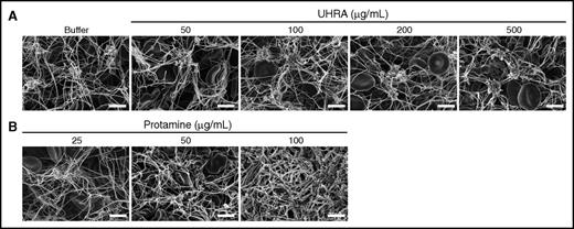 Figure 5. Clot characteristics formed in whole blood remain unchanged in the presence of UHRA. Clotting was initiated by recalcifying human whole blood with 11.1 mM CaCl2. Clot samples were then processed for SEM imaging. (A) Clots formed in the presence of 500 µg/mL UHRA did not undergo detectable morphological changes. (B) However, clots formed in the presence of 100 µg/mL protamine showed thicker clot fibers, less platelet aggregates, and complete abnormality in clot architecture. Also, at this concentration of protamine, tiny clots were obtained as a result of the intrinsic anticoagulation effect of protamine. Clotting was inhibited at higher concentrations. Clot images were taken at 2 original magnifications, ×2500 and ×5000. Only images from the original magnification ×5000 are depicted. Scale bar, 4 µm.