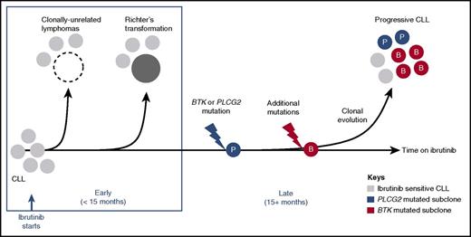 Figure 5. Molecular patterns of ibrutinib-resistant disease. A schematic representation of study findings. Sensitivity to ibrutinib is altered by histology and the presence of resistance-conferring mutations. Histologic transformation is an early event (<15 months in the study presented here), and can be de novo (clonally unrelated) or originate in the CLL clone (clonally related). Progressive CLL occurs later in the treatment course, and is frequently accompanied by BTK (red circles) and/or PLCG2 (blue circles) mutations. Multiple subclones can coexist, precede clinical progression by many months, and expand at different rates.