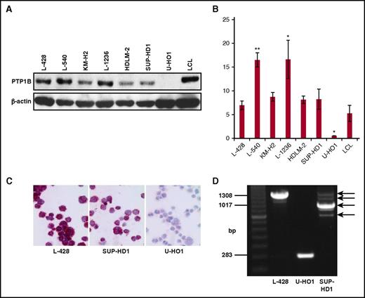 Figure 1. Characterization of PTP1B expression in cHL cell lines. (A) Western blot analysis of the indicated cHL cell lines and a lymphoblastoid cell line (LCL), using PTP1B and β-actin specific antibodies. (B) Quantification of the amount of PTP1B protein as depicted in A. Mean value of 3 independent experiments is shown, and significance was determined by a Student t test in comparison with the LCL values. *P ≤ .05; **P ≤ .01; ***P ≤ .001. (C) Immunocytochemical staining of PTP1B in the cHL cell lines L-428, SUP-HD1, and U-HO1. Original magnification ×400. (D) Endpoint PCR results of the amplified PTP1B cDNA of the cell lines L-428, U-HO1, and SUP-HD1. PCR products corresponding to the PTPN1 cDNAs of different size are marked by arrows.