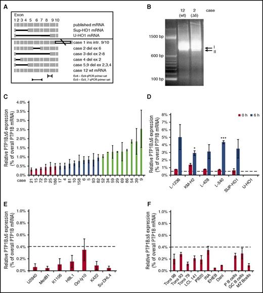 Figure 2. Analysis of PTPN1 mRNA variants in cHL. (A) Schematic representation of the identified and sequenced PTPN1 cDNA variants derived from primary cHL cases and cHL cell lines. (B) Endpoint PCR results of the amplified PTPN1 cDNA from laser-microdissected HRS cells of selected primary cHL cases. The PCR signal related to full-length PTPN1 mRNA (I) and the band corresponding to the PTPN1Δ6 mRNA (II) are indicated. (C) Percentage of the PTPN1Δ6 mRNA based on the whole PTPN1 mRNA levels in 24 cases from the cHL cohort measured by qPCR analyses. Three different groups are defined: group I, very low relative PTPN1Δ6 mRNA expression (cases 15, 19, 21, 25, 72, 186; red bars); group II, low relative PTPN1Δ6 mRNA expression (cases 4, 5, 6, 10, 17, 81, 82, 83, 158; blue bars); and group III, high relative PTPN1Δ6 mRNA expression (cases 9, 29, 34, 39, 52, 54, 59, 69, 86; light green bars). (D) Percentage of the PTPN1Δ6 mRNA based on the whole PTPN1 mRNA levels in the different cHL cell lines without and after stimulation with serum for 6 hours, measured by qPCR analyses. Significances are calculated in comparison with the control (0 hours) values. *P ≤ .05; **P ≤ .01; ***P ≤ .001. (E) Percentage of the PTPN1Δ6 mRNA based on the whole PTPN1 mRNA levels in other lymphoma cell lines (PMBL, ABC-DLBCL, GC-DLBCL) measured by qPCR analyses. (F) Percentage of the PTPN1Δ6 mRNA based on the whole PTPN1 mRNA levels in 8 control LCL cell lines (left) and microdissected B cells from lymph node sections. GC, germinal center; MZ, mantle zone (right part). (D-F) The dashed line marks the relative PTPN1Δ6 mRNA expression level of 0.4% observed in the group of laser-captured HRS cells with very low relative PTPN1Δ6 mRNA expression.