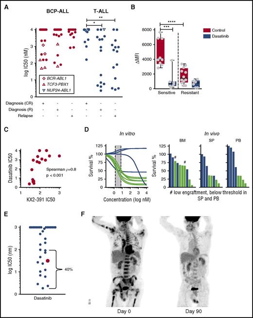 Figure 6. In vitro sensitivity of T-ALL to dasatinib correlates with antileukemic efficacy in the patient. (A) Subset of T-ALL patients at diagnosis that relapsed (R) and at relapse are highly sensitive to dasatinib in vitro. (B) Dasatinib-sensitive T-ALL cells have higher levels of phosphorylated SRC that decreases after treatment with 1 µM dasatinib for 2 hours as measured by flow cytometry. (C) Dasatinib response correlates with sensitivity to the SRC inhibitor KX2-391 (n = 16). (D) In vitro captured response correlates with in vivo response to dasatinib (n = 10). Indicated is the percent of T-ALL blasts compared with mouse lymphocytes normalized to vehicle-treated controls. (E) Sensitivity of adult and pediatric T-ALL patients to dasatinib reveals 40% of patients with IC50 below 100 nM. (F) Left: positron emission tomography/computed tomography (PET/CT) scan demonstrates significant disease burden throughout the marrow in bilateral upper and lower extremities, the pelvis, vertebrae, and contiguous nodes within the mediastinum. Right: PET/CT ∼15 months after the original presentation, shortly after initiation of dasatinib monotherapy. This image demonstrates complete response (CR) with no signs of marrow or nodal involvement. *P = .0272; **P = .0072; ***P = .0004; ****P = .0001. BM, bone marrow; PB, peripheral blood; SP, spleen.