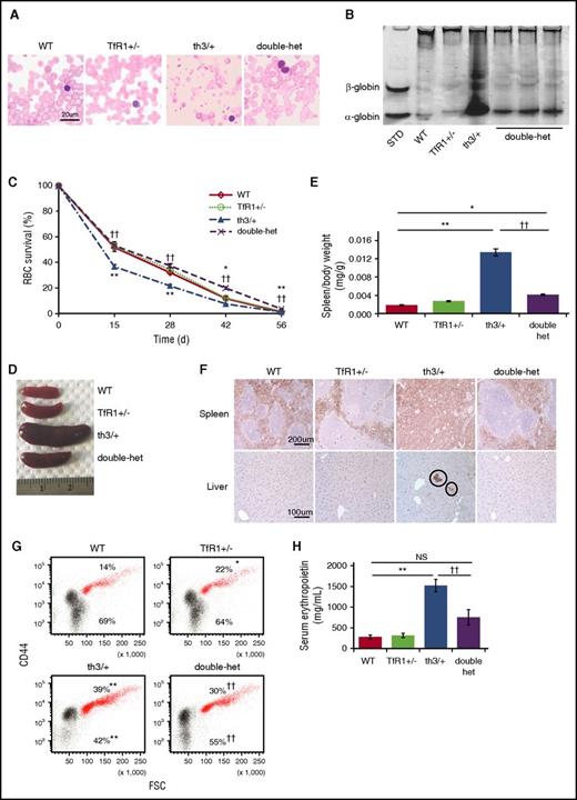 Figure 1. Improved ineffective erythropoiesis in double-heterozygote mice. (A) Morphology of RBCs in peripheral blood smears (n = 5 mice per group). (B) Deposition of α-globin on RBC membranes as assessed by analyzing proteins derived from RBC membranes using nondenaturing gel analysis. Data are representative of an experiment independently repeated five times. Standard “localization control,” RBC cytoplasmic lysate was run on the gel to identify where α- and β-globin migrate. (C) RBC survival in circulation from WT, TfR1+/−, th3/+, and double-heterozygote mice as measured by the decaying percentage of biotinylated RBCs over time (n = 4 mice per group). (D) Double-heterozygote mice exhibit smaller spleen size in comparison with th3/+ mice. (E) Statistical analysis of spleen/body weight (n = 5-6 mice per group). (F) Ter119 immunohistochemistry staining reveals more normal splenic architecture with more surface area devoted to white pulp (Ter119 negative cells) in TfR1+/− mice in relation to WT mice and in double-heterozygote mice in relation to th3/+ mice. In addition, Ter119 immunohistochemistry staining of liver sections reveals reversal of extramedullary erythropoiesis (circles) in double-heterozygote mice in relation to th3/+ mice (n = 4-6 mice per group). (G) Flow cytometry analysis of percentages of bone marrow erythroid precursors (red) and enucleated cells (black) from WT, TfR1+/−, th3/+, and double-heterozygote mice as identified by CD44 and forward scatter46,52 (n = 4-5 mice per group). (H) Serum erythropoietin concentration in WT, TfR1+/−, th3/+, and double-heterozygote mice (n = 4-5 mice per group). *P < .05 vs WT mice; **P < .01 vs WT mice; ††P < .01 vs th3/+ mice. Double-het = double-heterozygote mice; FSC, forward scatter; NS, not significant; STD, standard.