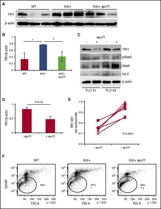 Figure 6. Apotransferrin decreases TfR1 and enhances enucleation in β-thalassemic erythroid precursors. (A) Protein concentration for TfR1 in CD45 negative bone marrow cells from WT, th3/+, and apotransferrin treated th3/+ mice. (B) Statistical analysis of TfR1/β-actin (n = 4-5 mice per group). (C) Protein expression of TfR1, pStat5, Stat5, Irp-2, and β-actin in fetal liver cells treated with apotransferrin in vitro (experiment repeated twice). (D) Statistical analysis of TfR1/β-actin in fetal liver cells treated with apoTf in vitro. (E) Proportion of TfR1 on extruded nuclei in relation to reticulocytes during in vitro enucleation of th3/+ fetal liver cells with and without additional apotransferrin (n = 6 pups per group). (F) Erythroid enucleation in WT, th3/+, and apotransferrin-treated th3/+ fetal liver cells (n = 3-4 pups per group). *P < .05; **P < .01 vs WT mice; †P < .05; ††P < .01 vs th3/+ mice. Ext nucleus, extruded nucleus; retic, reticulocyte; MFI, mean fluorescence index.