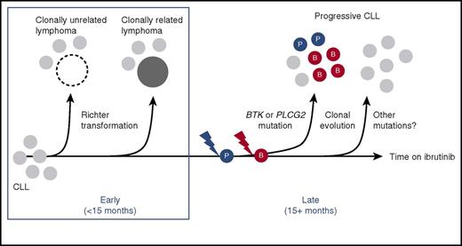 Development of resistance against ibrutinib in CLL. Treatment of CLL patients with ibrutinib has to be stopped because of development of clonally nonrelated aggressive lymphoma (Richter transformation), Richter transformation of a CLL subclone (both mostly occurring within 12 to 18 months of treatment initiation), progressing CLL concurring with acquisition of BTK and/or PLCG2 mutations (mostly occurring after 12 to 18 months of treatment), and possibly late progression in which no mutations of BTK or PLCG2 can be detected. The figure has been adapted from Figure 5 in the article by Ahn et al that begins on page 1469.