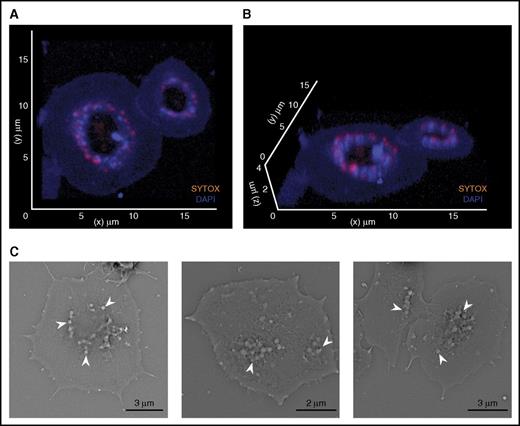 Figure 4. Polyphosphate nanoparticles are retained at the platelet granulomere after release. (A-B) Three-dimensional reconstruction of fixed spread platelets on immobilized VWF, analyzed by confocal microscopy (microscopic images were acquired at a magnification of ×630). Blue, DAPI; orange, SYTOX. (C) Scanning electron microscopy of spreading platelets. Arrows indicate spherical structures.