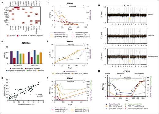 Figure 1. ctDNA as a disease monitoring strategy in MDS. (A) Mutations and cytogenetic abnormalities present among all patients recruited to the azacitidine + eltrombopag study. (B) MAF measured dPCR of a TP53 P177R and U2AF1 Q157P gene mutation in BM MNL, PB MNL, PB neutrophils, plasma ctDNA, and whole-blood DNA from a patient with high-grade MDS. The patient had no circulating blasts in the PB detected by morphology. BM morphology revealed multilineage dysplasia with an excess of myeloblasts (11% of nucleated cells). (C) Correlation between MAF measured by dPCR between BM and plasma ctDNA across 75 matched time points (r2 = 0.84; P < .0001). (D) Case AZA004. Serial comparison of the MAF of TET2 N1890I and TET2 D1376V mutation by dPCR between BM and plasma ctDNA. The patient had MDS with a classification of RAEB-2, which responded to azacitidine and eltrombopag therapy by a reduction in BM myeloblast percentage. At various time points (day 193, day 318, and day 599), poor-quality blood-dilute aspirate samples were obtained (denoted by *). At these times, plasma ctDNA MAF was higher than BM MAF of the TET2 N1890I and TET2 D1376V mutation. There was also severe neutropenia at these time points (neutrophils = 0.13, 0.15, and 0.16 × 109/L, respectively). (E) Case AZA009. Serial MAF of a NRAS G13D mutation by dPCR of BM and plasma ctDNA. The patient had RAEB-1 and stable disease after azacitidine and eltrombopag therapy represented by a persistent but stable excess of BM blasts. There was eventual progression at day 407 of therapy to acute myeloid leukemia. (F) Case AZA007. Serial MAF of a KRAS A59G and SRSF2 P95H mutation by TS of BM and plasma ctDNA, respectively. The patent had refractory cytopenia with unilineage dysplasia with severe thrombocytopenia, which responded initially to azacitidine and eltrombopag therapy. The patient eventually progressed with an increase in BM myeloblast percentage. Of note, the SRSF2 mutation, despite being reduced, still remained detectable in ctDNA at all time points sampled. At the time of disease progression, the MAF of the SRSF2 mutation in plasma had clearly increased, while the KRAS mutation remained undetectable. (G) Depth of coverage (DOC) log2 ratio plots from low-coverage whole-genome sequencing (LC-WGS) of plasma in patient AZA011. At “baseline” (top), the plot shows the presence of a loss of copy number at chromosome 9 (yellow) prior to azacitidine therapy. At “response” on day 167 (middle), there is near resolution of the copy-number alteration at chromosome 9. At day 1441, while still on therapy, at “pre-progression” (bottom) there is reemergence of the loss of copy number at chromosome 9 (yellow). (H) Serial MAF of a CBL, U2AF1, TET2, and an ASXL1 mutation of patient AZA011 throughout azacitidine and eltrombopag therapy. Response to therapy was achieved by an improvement in platelet count. The MAF of the CBL, U2AF1, and TET2 mutations reduced accordingly. At day 1441, all 3 of these MAFs increased alongside emergence of a new ASXL1 mutation. The patient subsequently progressed on day 1525 with thrombocytopenia and an increase in BM myeloblasts.