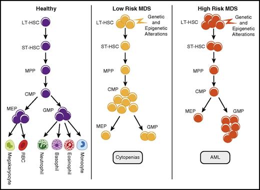Figure 1. Quantitative stem and progenitor alterations in MDS subgroups. Stem cells and various progenitor populations are shown in normal and myelodysplastic hematopoiesis. Although this is a simplified model of differentiation, recent studies have shown that multipotent progenitors (MPPs) and CMPs can take alternative paths toward differentiation. Expansion of phenotypic HSCs is seen in MDSs and is most pronounced in higher-risk subgroups. Lower-risk MDS samples are characterized by phenotypic CMP expansions and decreased MEPs. Higher-risk samples are associated with GMP expansions.1,4,12 RBC, red blood cell; ST-HSC, short-term hematopoietic stem cell.