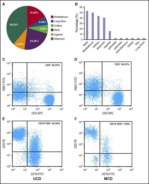 Figure 1. Lymph node involvement by location and immunophenotypic expression (CD3+ and CD5+/CD19+) in patients with UCD and iMCD subtypes of CD. (A) The distribution of lymphadenopathy among patients with HIV-negative UCD. (B) The locations of coexistent lymphadenopathies among patients with iMCD; (C,E) Flow cytometry images of CD3+ and CD5+/CD19+ in UCD; (D,F) flow cytometry images of CD3+ and CD5+/CD19+ in iMCD. FITC, fluorescein isothiocyanate; PE, phycoerythrin.