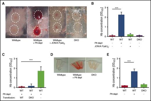 Figure 1. DKO mice maintain vascular integrity during inflammation of the skin and lung. (A-B) WT, platelet-depleted WT, WT treated with JON/A F(ab)2 to block integrin GPIIb/IIIa, and DKO mice were subjected to the rpA reaction to induce local skin inflammation. (A) Representative images. Inflammatory spots are highlighted. (B) Quantification of the Hb content in tissue punch biopsies from inflammatory spots. (C) Quantification of the Hb content in tissue punch biopsies from platelet-depleted hIL-4Rα/GPIbα–Tg mice transfused with WT or DKO platelets or untransfused mice subjected to the rpA reaction. (D-E) WT, platelet-depleted WT, and DKO mice were subjected to LPS-induced lung inflammation. (D) Representative images of BAL 4 hours after LPS application. (E) Quantification of the Hb content in BAL liquid. Results are presented as mean ± SD. n = 4 mice per group, representative of 3 independent experiments. ***P < .001. Plt depl, platelet depleted; SD, standard deviation.