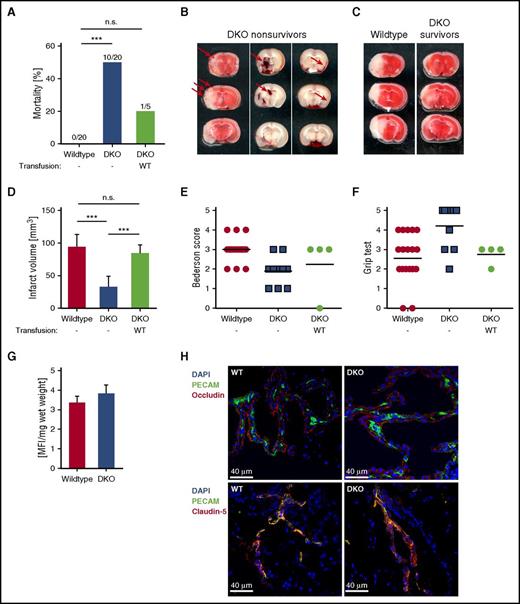 Figure 2. Increased rate of hemorrhage and mortality after tMCAO in DKO mice. (A) Mortality rates 24 hours after tMCAO of WT and DKO mice, as well as DKO mice transfused with WT platelets. (B) Representative images show microbleedings in TTC-stained brain sections (left) or intraparenchymal (middle) and subarachnoid (right) bleedings (arrows) in native brain sections of nonsurviving double-deficient mice after stroke. (C) Representative images of coronal sections stained with TTC 24 hours after tMCAO of WT and surviving DKO mice. Infarcted areas are shown in white. (D) Planimetric analysis was used to quantify the infarct volume. Results are presented as mean ± SD. n = 20 (WT), n = 10 (DKO), and n = 4 (DKO + WT platelets) mice. Bederson score (E) and grip test (F) were used to analyze neurologic outcome in the surviving animals 24 hours after tMCAO. Each symbol represents 1 mouse. n = 20 (WT), n = 10 (DKO), and n = 4 (DKO + WT platelets) mice. (G) Quantification of fluorescein isothiocyanate-dextran extravasation in brains from naïve WT and DKO animals. n = 5 mice per group. (H) Immune fluorescent staining of tight-junction proteins occludin and claudin-5 in brain sections from naïve WT and DKO animals using a 40× objective. Representative images from n = 3 mice per group. Scale bar 40 μm. ***P < .001. DAPI, 4,6 diamidino-2-phenylindole; MFI, mean fluorescence intensity; n.s., not significant; SD, standard deviation.