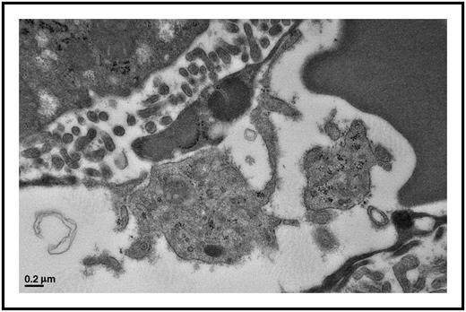 Platelets actively interact with liver endothelial cells in a Plasmodium berghei infection model. This platelet has formed a distinct contact interaction with the endothelial cell. These interactions occur in many tissue beds and with circulating immune cells contributing to the inflammatory pathogenesis of cerebral malaria. Electron microscopy image; scale bar, 0.2 μm.