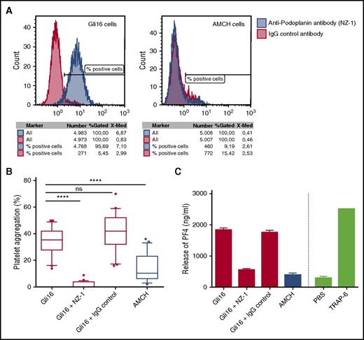 Figure 4. Podoplanin expression and tumor cell–induced platelet aggregation and platelet activation in vitro. (A) Podoplanin expression on cancer cell lines “Gli16” and “AMCH” was investigated by flow cytometry. (B) The ability of the cell lines to induce platelet aggregation was investigated by LTA: A total number of 5 × 105 cancer cells were added to 225 µL of PRP,and maximal platelet aggregation (%) after 10 minutes was recorded. Gli16 cells induced significantly stronger platelet aggregation compared with control cell line AMCH (***P < .001). Platelet aggregation in response to Gli16 was abrogated by the antipodoplanin antibody NZ-1, but not by control antibody (***P < .001). ns, not significant. Box plots show data from 5 individual experiments (performed in multiple replicates; total n = 22). (C) Platelet activation and degranulation upon coincubation of 225 µL PRP with 5 × 105 cancer cells was determined by a PF4 ELISA. Gli16 cells induced marked release of PF4 from platelets, which was not observed for AMCH cells. The ability of Gli16 cells to induce PF4 release from platelets could be inhibited by the anti-podoplanin antibody NZ-1, but not by control antibody. The experiment was performed in duplicates.
