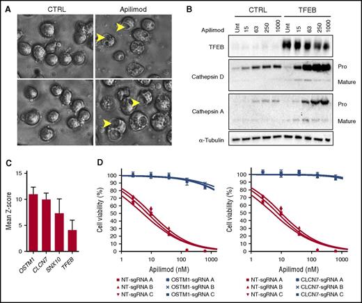 Figure 5. Apilimod disrupts lysosomal homeostasis and intracellular trafficking. (A) SU-DHL-6 cells were treated with DMSO or 63 nM apilimod for 24 hours and imaged at ×40 magnification. Arrows highlight vacuoles. Image sharpened evenly in order to highlight vacuoles present in floating lymphoma cells. (B) Apilimod induces procathepsin accumulation. Control (CTRL) TFEB-deficient or TFEB-overexpressing CA46 cells were dosed with increasing amounts of apilimod (15-1000 nM) for 24 hours. Lysates were probed with the indicated antibodies. The Pro and Mature forms of cathepsins A and D are indicated. Representative blot is shown from 2 independent experiments. (C) Mean Z-score for top 4 genes from CRISPR apilimod resistance screen. (D) WSU-DLCL2 B-NHL pools with the indicated OSTM1, CLCN7, or nontargeting (NT) sgRNA were treated with 10-point apilimod dose response for 3 days. Data are represented as mean ± SD. Unt, untreated.