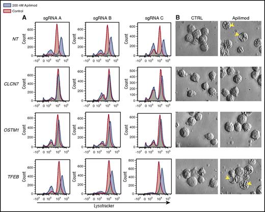Figure 6. Effect of CRISPR gene knockout on apilimod-induced lysosomal expansion. (A) LysoTracker staining in WSU-DLCL2 CRISPR knockout pools after 48-hour treatment with 200 nM apilimod (blue) compared with DMSO-treated control (red). Three independent sgRNA pools for each gene listed are displayed. (B) Corresponding images of vacuole formation in the cells are displayed (original magnification ×40). Arrows highlight vacuoles. Images sharpened evenly in order to highlight vacuoles present in floating lymphoma cells.