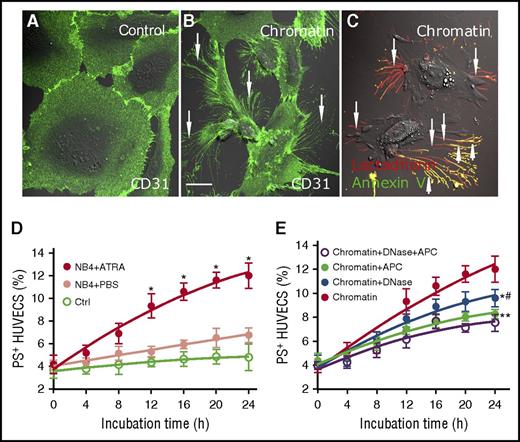 Figure 5. Promyelocytic extracellular chromatin triggers PS exposure on HUVECs. On the third day of PBS or ATRA treatment, extracellular chromatin from NB4 cells was isolated. HUVECs were incubated with or without isolated extracellular chromatin (50-fold concentrated) for 24 hours. Cells were stained with CD31-Alexa Fluor 488 (A-B) and with Alexa 647–lactadherin and FITC–annexin V (C). (A) Representative confocal microscopy image showed morphology of HUVECs incubated with culture medium without extracellular chromatin. (B-C) Stimulation with ATRA-derived chromatin led to the retraction of cell margins and extension of filopods (arrows) and PS exposure on the filopods (arrows), which costained with lactadherin (red) and annexin V (green). The inset bar represents 5 μm in panels A-C. One of 6 independent experiments is shown. (D) Kinetics of PS reversal on ECs with different treatment. (E) For inhibition assays HUVECs were incubated with isolated ATRA-derived chromatin in the presence or absence of DNase I or APC. One of 6 independent experiments is shown. Each point represents mean ± SD. *P < .001 vs PBS-treated group in panel D; *P < .01, **P < .001 vs no inhibitor group and #P < .05 vs DNase-treated group in panel E.