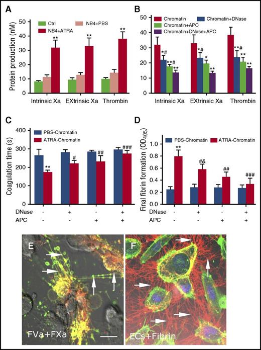 Figure 6. Promyelocytic extracellular chromatin converts HUVECs into a procoagulant phenotype. (A) Thrombin and intrinsic Xa and extrinsic Xa production were measured on HUVECs treated with NB4 extracellular chromatin from the different treatment groups. (B) Inhibition assays of protein production were performed using DNase I or APC to degrade extracellular chromatin before incubation with ECs. Coagulation time (C) and fibrin formation (D) of ECs stimulated with ATRA- or PBS-derived NB4 chromatin for 24 hours in the presence of DNase I or APC were measured. Data shown from 3 independent experiments and presented as mean ± SD. (E) FXa (red) and FVa (green) costaining (yellow) was observed on filopods near the retracted edges of ECs and on newly formed thin filaments (arrow), similar to the binding sites for lactadherin. (F) ECs pretreated with ATRA-derived chromatin and incubated with healthy plasma showed considerable fibrin strand formation arranged radially along with filopodia (arrow), which formed a fibrin network. The inset bar represents 5 μm in panels E-F. One of 6 independent experiments is shown. *P < .01, **P < .001 vs no inhibitor group and #P < .05 vs DNase I (+) APC (+) in panel B; **P < .001 vs PBS-treated NB4 cells in panels A, C, D; #P < .05, ##P < .01, ###P < .001 vs DNase I (-) APC (-) in panels C-D; &P < .05 vs DNase I (+) APC (+) in panel D.