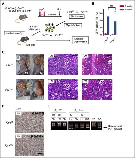 Figure 1. Fzr1-intact and Fzr1-deficient B-ALL share similar pathological characteristics. (A) Experimental design for retrovirus-mediated introduction of Mycn into Fzr1-intact (Fzr1f/f) or Fzr1-deficient (Fzr1∆/∆) BM-MNCs and transplantation of the infected cells into WT recipient mice (see Materials and methods for experimental details). 5FU, 5-fluorouracil. (B) Flow cytometry–based determination of the proportion of GFP+ cells in the PB of recipient mice immediately and 9 weeks after transplantation of Mycn-overexpressing Fzr1-intact or Fzr1-deficient BM-MNCs. The data are presented as mean ± standard deviation (SD) (n = 3 mice per group). NS, not significant; P = .44. (C) Gross appearance of enlarged lymph nodes (left) as well as hematoxylin and eosin staining of affected LNs (middle) and BM (right) in mice given Fzr1-intact (top) or Fzr1-deficient (bottom) cells when they became moribund. Insets show higher-magnification views. Scale bars, 50 µm (low power) or 20 µm (high power). (D) Immunohistochemical staining of Ki67 in affected lymph nodes as in panel C. The percentages of Ki67+ cells are shown as mean ± SD determined for 3 mice of each group. Scale bars, 50 µm. (E) Representative PCR-based genotyping of sorted GFP+ cells from affected lymph nodes or BM of individual recipient mice. NC, negative control consisting of genomic DNA from BM cells of Mx1-Cre(−);Fzr1f/f mice; PC, positive control, consisting of genomic DNA from BM cells of Mx1-Cre(+);Fzr1f/f mice after pIpC injection.