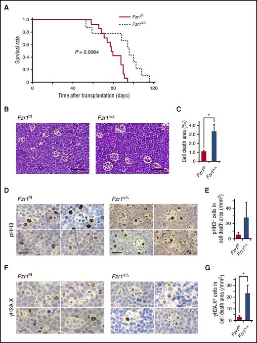 Figure 2. Longer survival in mice with Fzr1-deficient B-ALL than in those with Fzr1-intact B-ALL is associated with increased B-ALL cell fragility induced by DNA DSBs. (A) Survival curves for mice with B-ALL originating from Fzr1-intact (n = 14 mice) or Fzr1-deficient (n = 9 mice) BM cells. The P value was determined with the log-rank test. (B) Areas of cell death (outlined with yellow dotted lines) in hematoxylin and eosin–stained sections of B-ALL–affected lymph nodes from moribund recipient mice. Scale bars, 50 µm. (C) Proportion of lymph nodes occupied by areas of cell death as determined for sections in panel B. The data are presented as the mean ± SD (n = 3 mice per group). *P = .049. (D and F) Immunohistochemical staining for pHH3 (D) and γH2A.X (F) in affected lymph nodes from mice with Fzr1-intact or Fzr1-deficient B-ALL. Scale bars, 20 µm. (E and G) Density of cells positive for pHH3 (E) or γH2A.X (G) in areas of cell death as determined for sections similar to those in panels D and F, respectively. The data are presented as mean ± SD (n = 3 mice per group). P = .191 for pHH3; *P = .0077 for γH2A.X.
