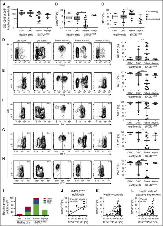 Figure 1. High prevalence of NK cells displaying lack of intracellular signaling protein and PLZF expression in patients with GATA2 mutation. PBMCs from CMV-seronegative (n = 69) and -seropositive (n = 127) healthy donors as well as patients (n = 10) and asymptomatic carriers (n = 3) with heterozygous GATA2 mutations were examined by flow cytometry. Graphs depict (A) the number of total NK cells as defined by CD3−CD56+/CD16+ cells in the lymphocyte gate, (B) the percentage of CD3−CD56bright NK cells within the total CD3−CD56+/CD16+ NK-cell population, and (C) the percentage of CD3−CD56dim NK cells expressing CD57. (D-H) Contour plots show CD3−CD56dim NK cells from representative CMV-seronegative and -seropositive healthy donors as well as 2 patients and 1 asymptomatic carrier with GATA2 mutations. Expression of CD57 is plotted against (D) NKG2C or the intracellular proteins (E) FcεRγ, (F) SYK, (G) EAT-2, and (H) PLZF. (D-H) Graphs depict the percentages of CD3−CD56dim NK cells expressing NKG2C, FcεRγ, SYK, EAT-2, or PLZF, as indicated. In the graphs (A-H), CMV serostatus for GATA2 patients and carriers is indicated as seronegative (open circles), seropositive (gray circles), or undetermined (black circles). (A-H) Boxes indicate 25th, 50th (median), and 75th percentiles, with a plus indicating the mean. For box plots, whiskers indicate 95% confidence intervals. Otherwise, error bars indicate mean with standard deviation (SD). P values were determined using the Student unpaired t test. *P < .05, **P < .01, and ***P < .001. (I) The overall frequency of healthy controls (ctrls, stratified on CMV seropositivity, or individuals with GATA2 mutations with significant, sizeable downregulations of 1, 2, or 3 of the signaling proteins FcεRγ, SYK, and EAT-2 is plotted. (J) In individuals with GATA2 mutation, the percentage of CD3−CD56bright NK cells within the total CD3−CD56+/CD16+ NK-cell population is plotted as a function of the frequency of PLZF-expressing CD3−CD56dim NK cells. (K) Among healthy controls, the percentage of CD3−CD56bright NK cells within the total CD3−CD56+/CD16+ NK-cell population is plotted as a function of the frequency of PLZF-expressing CD3−CD56dim NK cells. The CMV serostatus is indicated as seronegative (open circles) seropositive (gray circles). (L) Among healthy controls with sizeable adaptive NK-cell expansions as defined by PLZF deficiency, the percentage of CD3−CD56bright NK cells within the total CD3−CD56+/CD16+ NK-cell population is plotted as a function of the frequency of PLZF-expressing CD3−CD56dim NK cells. Healthy controls with sizeable adaptive NK-cell expansions were overwhelmingly CMV seropositive (gray circles).