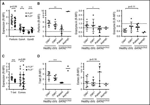Figure 3. Cytotoxic granule constituent and T-bet expression pattern resembling adaptive NK cells in patients with GATA2 mutation. PBMCs, healthy donors, and individuals with heterozygous GATA2 mutations were examined for expression of cytotoxic granule constituents perforin, granzyme A (GzmA), and granzyme B (GzmB) as well as the transcription factors T-bet and Eomes by intracellular flow cytometry. Expression is shown as median fluorescence intensity relative to (R-MFI) CD3+CD8+CD57+ T cells in the same sample. (A) The graph depicts expression of perforin, granzyme A and B in conventional PLZF+ (open circles) and adaptive PLZF− (filled circles) CD3−CD56dim NK cells from healthy adult CMV-seropositive donors (n = 16) with sizeable pools of adaptive NK cells. (B) The graphs depict perforin, granzyme A and B expression in CD3−CD56dim NK cells from healthy CMV-seronegative (n = 6) and -seropositive donors (n = 6), as well as patients (n = 8) or asymptomatic carriers (n = 2) with GATA2 mutation. (C) The graph depicts expression of T-bet and Eomes in conventional PLZF+ (open circles) and adaptive PLZF− (filled circles) CD3−CD56dim NK cells from healthy adult CMV-seropositive donors with sizeable pools of adaptive NK cells (n = 16). (D) The graphs depict T-bet and Eomes expression in CD3−CD56dim NK cells from healthy CMV-seronegative (n = 6) and -seropositive donors (n = 6), as well as patients (n = 6) or asymptomatic carriers (n = 2) with GATA2 mutation. Mean is indicated, with error bars representing SD. P values were determined using the Student (A,C) paired and (B,D) unpaired t test. **P < .01 and ***P < .001.