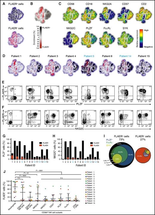 Figure 2. NK cells with adaptive phenotype are largely GPI positive. PMBCs from 15 PNH patients were analyzed by flow cytometry. (A-D) Plots depict Barnes-Hut t-SNE analysis of 9-parametric data performed on gated CD56+ NK cells from all PNH patients. FLAER expression was not included as a parameter in the t-SNE analyses. (A) Distribution in the t-SNE field of GPIpos (FLAER+, top plot) and GPIneg (FLAER−, bottom plot) CD56+ NK cells from all patients. (B) Cumulative enrichment of GPIpos (FLAER+) and GPIneg (FLAER−) CD56+ NK cells from all patients according to the t-SNE field, as indicated. (C) Protein expression levels for single parameters in t-SNE field, as indicated. (D) Cell density in the t-SNE field for selected, individual patients, as indicated, with black and red dots indicating GPIpos (FLAER+) and GPIneg (FLAER−) CD56+ NK cells, respectively. Supplemental Figure 3 shows the individual t-SNE fields for all patients. (E-F) Flow plots depict (E) PLZF or (F) NKG2C vs FLAER expression on gated CD56dim NK cells in individual patients, as indicated. (G-H) Graphs indicate the frequency of (G) PLZF− and (H) NKG2C+ cells, also designating the proportion of which expressed FLAER or not, among CD56dim NK cells in individual patients, as indicated. (I) Venn diagrams depict the relative abundance of canonical and different adaptive CD56dim NK-cell subsets, as defined by lack of PLZF, FcεRγ , and SYK expression. Only samples with GPIneg neutrophils >75% are included (n = 9). (J) Analysis of the fractions of GPIneg cells in different NK cells subsets, neutrophils, and CD3+ T cells of 15 PNH patients. GPI expression was quantified in CD56dim NK cells either coexpressing NKG2A, NKG2C, and CD57 or lacking expression of PLZF or FcεRγ. The gating strategy defining positive and negative cells for each NK-cell marker, and expression profile for each patient, can be found in supplemental Figure 3. Each color depicts an individual patient. Full circles indicate CMV seropositive, whereas open circles indicate CMV seronegative. n.s., not significant, 1-way analysis of variance followed by multiple comparisons (Holm-Šídák).