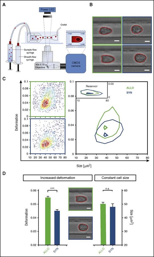 Figure 6. Early modifications in ECs have significant functional consequences as indicated by profoundly higher deformation in RT-DC. (A) RT-DC setup and measurement principle (inset shows top view of constriction). (B) Representative images of liver ECs from ALLO (green square) and SYN (blue square) mice at day+2 after BMT (LP/J→C57BL/6) acquired by RT-DC. (C) RT-DC measurements. Scatter plot of deformation vs cell size (cross-sectional area) of 1510 cells (dots). Color indicates a linear density scale. Density contour plots (50%) of ALLO vs SYN mice. (D) Mechanical phenotyping of liver ECs of ALLO and SYN mice at day+2 after BMT (LP/J→C57BL/6). Mean values n = 3. Deformation P = .0002, size P = .285 (***P ≤ .001) by a likelihood ratio test. Images are analyzed for cell size and cell shape (red contours). Scale bar, 5 µm. CMOS, complementary metal-oxide-semiconductor; LED, light-emitting diode.