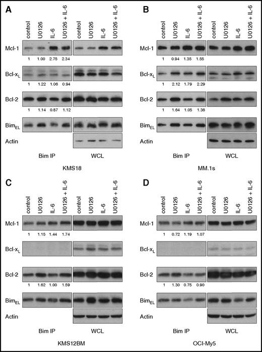 Figure 6. MEK inhibition increases Bcl-2 dependence. (A) KMS18, (B) MM.1s, (C) KMS12BM, and (D) OCI-My5 were treated with 1 ng/ml IL-6 and/or 10 μM U0126 for 24 hours, and protein lysates were prepared and then subjected to coimmunoprecipitation with anti-Bim antibodies. The resulting protein complexes and protein input (WCL) were examined by western blot analysis using anti-Bim, anti-Mcl-1, anti-Bcl-xL, anti-Bcl-2, and anti-actin. The amount of coprecipitated protein was quantitated by densitometry and normalized to control. Figures are representative of 2 to 3 independent experiments.