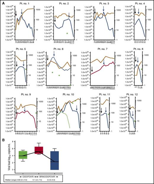 Figure 2. Kinetics of adenoviremia in 12 patients treated with cidofovir followed by brincidofovir. (A) Kinetics of adenoviremia (plotted on left y-axis) and corresponding lymphocyte count (plotted on right y-axis) in 12 episodes treated with cidofovir followed by brincidofovir. Days after HCT are plotted on x-axis. Black arrows indicate the start of cidofovir and blue arrows indicate the start of brincidofovir. Major (blue line) and minor (broken blue line) responses were observed in 9 of 11 episodes unresponsive to cidofovir. No response in 2 weeks is shown as red line. The circulating lymphocyte count is shown as brown line and CD4+ T-cell count (where available) is shown as green diamonds. The median circulating lymphocyte count at CR was 300/μL (160 to 3000). In patient number 10, coexistent CMV viremia (broken green line) resulted in T-cell expansion and resolution of CMV viremia. However, adenoviremia and gut adenoviral disease continued despite CD4+ T-cell reconstitution. Adenovirus-specific T-cell response was absent despite CD4+ T-cell expansion (shown as green circle). In the remaining 7 patients who had lymphocyte subsets measured, CD4+ T cells were <100/μL. (B) Change in adenovirus load between cidofovir and brincidofovir in patients unresponsive to cidofovir (n = 11). The median change in log10 viral load on cidofovir treatment was +1.2 (range, 0.3 to 2.3). In contrast, median change in log10 viral load after 2 weeks of brincidofovir treatment was −2.9 (range, −5.1 to 0.6; P < .005). The solid lines represent median and IQR, and whiskers represent minimum and maximum values. Pt, patient.
