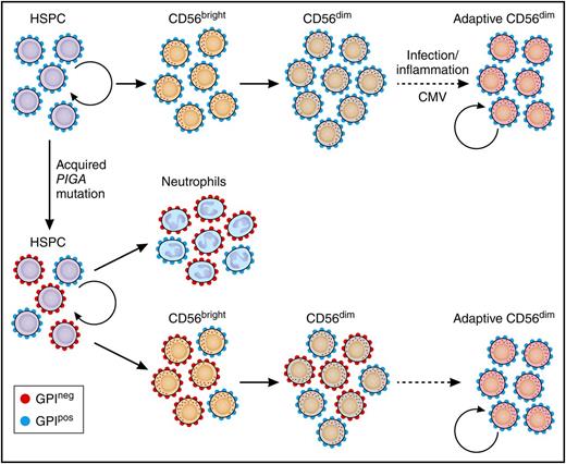 Somatic PIGA in HSPCs reveals longevity of adaptive NK cells. Normal HSPCs give rise to CD56bright NK cells that further develop to canonical CD56dim NK cells. Adaptive, CD56dim NK cells derive from canonical CD56dim NK-cell precursors in response to environmental stimuli. Patients with an acquired PIGA mutation exhibit mixed chimerism of GPIpos and GPIneg myeloid cells (represented here by neutrophils), reflecting the ongoing clonal contribution of PIGA-mutated self-renewing HSPCs. CD56bright NK cells develop proportionally from GPIpos and GPIneg HSPCs similar to myeloid cells. However, GPIneg cells are underrepresented in the CD56dim NK population, most prominently in CD56dim NK cells with adaptive phenotype. The persistence of GPIpos NK cells in PNH patients supports the notion of long-lived NK-cell adaptive NK cells with self-renewal capacity similar to memory T cells. See Figure 4 in the article by Corat et al that begins on page 1940. Professional illustration by Patrick Lane, ScEYEnce Studios.