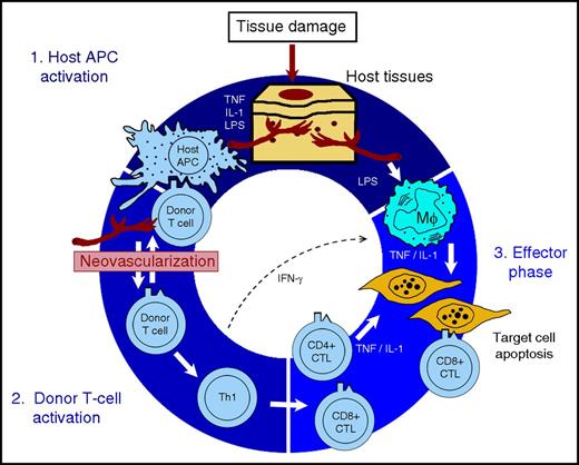 Pathomechanism of GVHD including neovascularization. APC, antigen-presenting cell; CTL, cytotoxic T lymphocyte; IFN, interferon; IL, interleukin; LPS, lipopolysaccharide; Mϕ, macrophage; Th1, T helper 1 cell; TNF, tumor necrosis factor. Modified and reprinted with permission from Elsevier (The Lancet, 2009, 373, 1550-1561).6