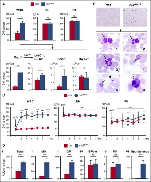 Figure 1. Analysis of PB parameters and colony formation assay. (A) PB parameters of control and CblQ367P mice. A higher total WBC count was observed in CblQ367P mice, which was mainly due to the proliferation of Mac1+ myelomonocytes, including Ly6C++, CD43+ monocytic cells, and B220+ B lymphoid cells. (B) Giemsa-stained PB smears from control and CblQ367P mice. The higher number of WBCs in the PB of CblQ367P mice and higher magnification of WBCs with abnormal morphologies are shown in the upper and lower panels, respectively. Panels 1 and 2: WBCs with pseudo–Pelger-Huet anomaly and abnormal nuclei (indicated by arrows); panel 3: a hypersegmented neutrophil (indicated by an arrow); and panels 4–6: giant platelets, an erythrocyte with a Howell-Jolly body, and an apoptotic cell (indicated by arrows, an arrowhead, and a white arrowhead, respectively). (C) Changes of PB parameters during the observation period. CblQ367P mice exhibited a sustained elevation of WBC numbers after pIpC stimulation. (D) Hematopoietic colony numbers of control and CblQ367P mice. CblQ367P hematopoietic cells exhibited a significant increase in total, mix, and GM colonies and generated a remarkable number of spontaneous colonies. ***P < .001; **P < .01; *P < .05. ns, not significant.
