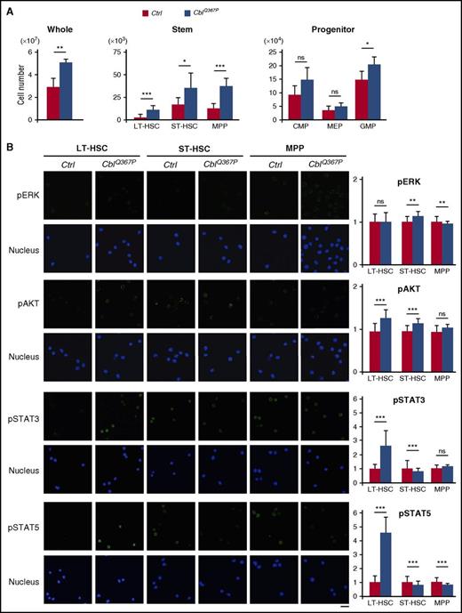 Figure 2. Analysis of HSPC numbers and detection of activated signaling pathways. (A) Comparison of cell numbers of whole, stem, and progenitor fractions in the control and CblQ367P BM. (B) Activation of ERK, AKT, STAT3, and STAT5 proteins in the HSC subpopulations. Representative photos taken with a confocal microscope and relative fluorescent intensities to those of control LT-HSCs are shown in the left and right panels, respectively. Scale bar: 10 μm. ***P < .001; **P < .01, *P < .05. ns, not significant.
