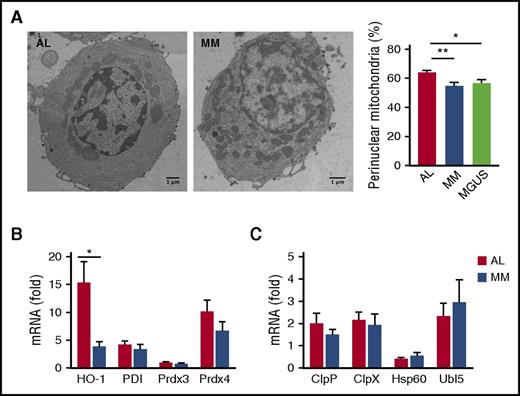 Figure 5. Mitochondrial stress in primary amyloidogenic PCs. Assessment of mitochondrial morphology and homeostasis in primary BM PCs purified from AL and MM patients by EM and transcripts analysis. (A) Representative EM images of BM PCs in AL, MM, and MGUS patients and analysis of cellular distribution of mitochondria. The percentage of perinuclear mitochondria was arbitrarily estimated as the proportion of mitochondria within half of the distance between perinuclear and plasma membrane (>20 PCs per patient; 9 AL, 6 MM, 3 MGUS primary samples per group). (B-C) Abundance of transcripts encoding HO-1 and organelle-resident redox sensors (B) and effectors of the mitochondrial UPR (C) assessed by quantitative reverse transcription PCR (8 AL and 7 MM patients). Histograms show mean values ± standard error. *P < .05; **P < .005 (Student t test). ClpP, caseinolytic mitochondrial matrix peptidase proteolytic subunit; ClpX, caseinolytic mitochondrial matrix peptidase chaperone subunit; Hsp60, heat shock protein 60; PDI, protein disulfide isomerase; Prdx3, peroxiredoxin 3; Prdx4, peroxiredoxin 4; Ubl5, ubiquitin-like 5.