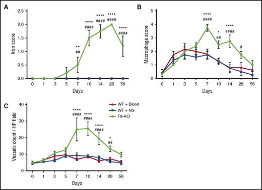 Figure 2. Time course of joint wound healing parameters is abnormal within blood-exposed joint synovium in mice with hemophilia in comparison with hemostatically normal mice. (A) Iron staining in joint wounds from WT and FIX−/− mice. Iron released from degraded erythrocytes in the ferric (+3) state stains blue, heaviest areas of staining within joints of all mice were graded 0 to 3+, and the means and standard deviation for all cohorts of mice are plotted. Iron in hemoglobin is in the ferrous (+2) state so that intact red blood cells are not stained. Plots of the data for both groups of WT mice overlap completely. Points that are significantly different from “WT + Blood” are indicated by “*.” Points that are significantly different from “WT + NS” are indicated by “#.” Markers of significance are used as follows: **P < .01, ****P < .0001, ##P < .01, ####P < .0001. (B) Macrophage infiltration and residence in joint wounds from WT and FIX−/− mice. Macrophage infiltrate was identified by immunostaining for CD68 and scored as described in the supplemental Methods. Points that are significantly different from “WT + Blood” are indicated by “*.” Points that are significantly different from “WT + NS” are indicated by “#.” Markers of significance are used as follows: *P < .05, ****P < .0001, #P < .05, ##P < .01, ####P < .0001. (C) Angiogenesis in joint wounds in WT and FIX−/− mice. Vascular endothelial cells were identified by staining for VWF with a rabbit polyclonal primary antibody (Abcam, Cambridge, MA). The counts are expressed per high-powered (×40) field. Points that are significantly different from “WT + Blood” are indicated by “*.” Points that are significantly different from “WT + NS” are indicated by “#.” Markers of significance are used as follows: *P < .05, ****P < .0001, ##P < .01, ####P < .0001.
