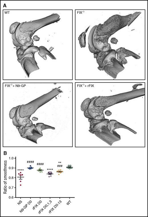 Figure 4. Abnormal bone wound healing and FIX replacement to maintain health of bones following hemarthrosis in normal and in FIX−/− mice. (A) Preservation of articulating surface of joint following hemarthrosis (microCT images). Three-dimensional rendering of the injured knee joint from microCT imaging obtained at 2 weeks after a single induced hemarthrosis followed by a single dose of placebo or FIX therapy at 20 minutes after wounding. WT: Hemostatically normal mouse, sham treated with IV NS. FIX−/−: Hemophilia B mouse sham treated with IV NS. FIX−/− + rFIX: Hemophilia B mouse treated with rFIX (Benefix) 250 IU/kg IV. FIX−/− + N9-GP: Hemophilia B mouse treated with glycoPEGylated rFIX (N9-GP) 250 IU/kg IV. (B) Quantification of loss of integrity of articulating surface of the joint following hemarthrosis (“ratio of smoothness”). To quantify the observed loss of surface integrity, a mathematical model was derived from the imaged joints that calculated the shape of a theoretically perfectly smooth joint surface, which was assigned a value of 1.0. Any imaged depressions or elevations resulted in deviations from absolute smoothness, resulting in values of <1.0, giving a measurement of “ratio of smoothness” that is less than the ideal. At 2 weeks after the induced hemarthrosis, joints from animals treated with N9-GP demonstrated preservation of articular surface smoothness that was not statistically significantly different from that seen in hemostatically normal WT mice (ratio = 0.901 and 0.906, respectively). rFIX was less effective at preserving the integrity of the surface of the articulating bones. Points that are significantly different from “WT” are indicated by “*.” Points that are significantly different from “NS” are indicated by “#.” Markers of significance are used as follows: **P < .01, ****P < .0001, ###P < .001, ####P < .0001.