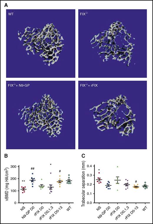 Figure 5. Abnormal trabecular bone health and FIX to support bone preservation following hemarthrosis in normal and in FIX−/− mice. (A) Experimental animals include the same conditions as in Figure 4, that is, 2-week postinjury images from sham-treated WT, sham-treated FIX−/−, and hemophilia B mice treated at 20 minutes after wounding with a single dose of 250 IU/kg IV rFIX (Benefix) FIX−/− + rFIX or a single dose of 250 IU/kg IV glycoPEGylated rFIX (N9-GP) FIX−/− + N9-GP. Images of the trabecular bone region of analysis of the proximal tibia demonstrate less bone in the representative image from the injured, placebo-treated hemophilia B mouse when compared with the WT placebo-treated mouse, as well as relatively less good preservation of bone density by single-dose rFIX in comparison with N9-GP. (B) Quantitative analysis of vBMD outcomes at 2 weeks following injury. Although large variations between mice were seen within each group, single-dose rFIX only partially preserved connectivity density of the trabecular struts, whereas the N9-GP or the 2 week replacement with rFIX preserved connectivity. (C) Trabecular bone microarchitecture changes following hemarthrosis include increase in trabecular separation in hemophilia mice compared with mice with intact hemostasis. Mean trabecular separation was preserved following hemarthrosis (not different from WT) by each of the replacement rFIX and N9-GP approaches. Normal trabecular separation was preserved by a single dose of N9-GP but required multiple dose rFIX therapy. Points that are significantly different from “WT” are indicated by “*.” Points that are significantly different from “NS” are indicated by “#.” Markers of significance are used as follows: *P < .05, **P < .01, #P < .05, ##P < .01.