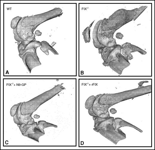 Abnormal bone wound healing using microCT in hemophilia B mice. In (A) hemostatically normal wild-type (WT), (B) untreated hemophilia B (FIX−/−), (C) hemophilia B treated with long-activing recombinant nonacog β pegol (N9-GP), or (D) unmodified rFIX mice. See Figure 4A in the article by Sun et al that begins on page 2161.