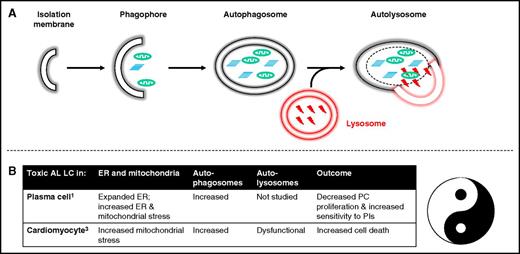 (A) Autophagy. An isolation membrane engulfs cytoplasm or organelle to form a double-membrane cytosolic vesicle referred to as an autophagosome. This autophagosome fuses with a late endosome or a lysosome to form an autophagolysosome. Inside the autophagolysosome, the lysosomal hydrolases degrade the sequestered material, which then becomes available to the cell for recycling. (B) Similar processes in plasma cells1 and cardiomyocytes3 have net opposing effects for the patient. Amyloidogenic immunoglobulin light chain induced dysregulated autophagy in a malignant PC favors cell death, which is good for the patient. In contrast, dysregulated autophagy in a cardiomyocyte also favors cell death, which is bad for the patient. ER, endoplasmic reticulum.