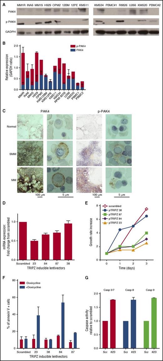 Figure 1. PAK4 expression affects growth and survival in MM. (A) Protein lysates from a panel of MM cell lines were analyzed for PAK4 and p-PAK4 expression by WB. GAPDH was used as loading control. One representative experiment of 2 is shown. (B) PAK4 and p-PAK4 relative expression levels. Data reported represent mean of 3 independent experiments. (C) Representative images of PAK4 and p-PAK4 immunocytochemistry stain in BM from normal, SMM, and symptomatic MM individuals. Scale bars: 100 μm and 5 μm. (D) Genetic depletion of PAK4 was achieved using 4 different tetracycline-inducible pTRIPz-Turbo-RFP vectors (Thermo Scientific, Pittsburgh, PA) containing the target sequence or scrambled control. Transfected MM1S cells were plated in growth medium in the absence or presence of 2.5 μg/mL doxycycline. qPCR analysis (right panel) was performed at day 3, confirming decreased PAK4 mRNA levels in cells expressing inducible PAK4 shRNAs compared with scrambled cells. (E) Cellular proliferation was evaluated by (3H)-thymidine uptake and presented as growth rate increase compared with t = 0. In medium containing doxycycline, reduced expression of PAK4 is accompanied by a reduction of cell growth rate compared with control cells. (F) Apoptosis was evaluated after 3 days of induction with 2.5 μg/mL doxycycline, using Annexin V and propidium iodide (PI) staining followed by flow cytometry acquisition and analysis. (G) Caspases activation was evaluated after 3 days of induction with 2.5 μg/mL doxycycline by luminescence assay.